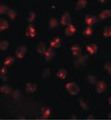 KIAA0703 / SPCA2 Antibody - Immunofluorescence of ATP2C2 in 3T3 cells with ATP2C2 antibody at 20 ug/ml.