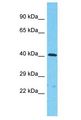 KIAA1147 Antibody - KIAA1147 antibody Western Blot of RPMI-8226. Antibody dilution: 1 ug/ml.  This image was taken for the unconjugated form of this product. Other forms have not been tested.