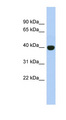 KIAA1191 Antibody - KIAA1191 antibody Western blot of Placenta lysate. This image was taken for the unconjugated form of this product. Other forms have not been tested.