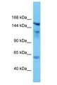 KIAA1462 Antibody - KIAA1462 antibody Western Blot of 721_B. Antibody dilution: 1 ug/ml.  This image was taken for the unconjugated form of this product. Other forms have not been tested.