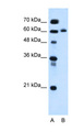 KIAA1754L / ITPRIPL1 Antibody - ITPRIPL1 / KIAA1754L antibody ARP44574_P050-NP_001008949-KIAA1754L(KIAA1754-like) Antibody Western blot of HepG2 cell lysate.  This image was taken for the unconjugated form of this product. Other forms have not been tested.