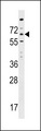 KIAA1754L / ITPRIPL1 Antibody - ITPRIPL1 Antibody western blot of HepG2 cell line lysates (35 ug/lane). The ITPRIPL1 antibody detected the ITPRIPL1 protein (arrow).