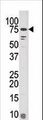 KIAA1811 / BRSK1 Antibody - Western blot of anti-KIAA181 antibody in mouse liver tissue lysate (35 ug/lane). KIAA181(arrow) was detected using the purified antibody.