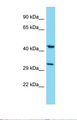 KIAA1826 Antibody - Western blot of Human A549. MSANTD4 antibody dilution 1.0 ug/ml.  This image was taken for the unconjugated form of this product. Other forms have not been tested.