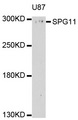 KIAA1840 / SPG11 Antibody - Western blot analysis of extracts of U-87MG cells, using SPG11 antibody at 1:1000 dilution. The secondary antibody used was an HRP Goat Anti-Rabbit IgG (H+L) at 1:10000 dilution. Lysates were loaded 25ug per lane and 3% nonfat dry milk in TBST was used for blocking. An ECL Kit was used for detection and the exposure time was 90s.
