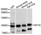 KIF19 Antibody - Western blot analysis of extracts of various cell lines, using KIF19 antibody at 1:3000 dilution. The secondary antibody used was an HRP Goat Anti-Rabbit IgG (H+L) at 1:10000 dilution. Lysates were loaded 25ug per lane and 3% nonfat dry milk in TBST was used for blocking. An ECL Kit was used for detection and the exposure time was 10s.