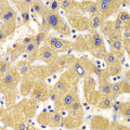KIF1B / CMT2 Antibody - Immunohistochemistry of paraffin-embedded Human liver injury tissue.