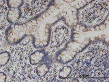 KIF1C Antibody - Immunoperoxidase of monoclonal antibody to KIF1C on formalin-fixed paraffin-embedded human small Intestine. [antibody concentration 3 ug/ml]