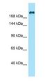 KIF21B Antibody - KIF21B antibody Western Blot of HeLa.  This image was taken for the unconjugated form of this product. Other forms have not been tested.