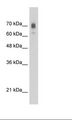 KIF22 / OBP Antibody - Jurkat Cell Lysate.  This image was taken for the unconjugated form of this product. Other forms have not been tested.