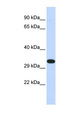 KIF25 Antibody - KIF25 antibody Western blot of 293T cell lysate. This image was taken for the unconjugated form of this product. Other forms have not been tested.