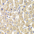 KIF3A Antibody - Immunohistochemistry of paraffin-embedded Human liver injury tissue.