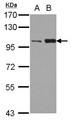 KIF3C Antibody - Sample (30 ug of whole cell lysate) A: HeLa B: HepG2 7.5% SDS PAGE KIF3C antibody diluted at 1:3000