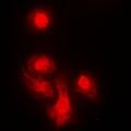 KIF4A Antibody - Immunofluorescent analysis of KIF4A staining in MCF7 cells. Formalin-fixed cells were permeabilized with 0.1% Triton X-100 in TBS for 5-10 minutes and blocked with 3% BSA-PBS for 30 minutes at room temperature. Cells were probed with the primary antibody in 3% BSA-PBS and incubated overnight at 4 C in a humidified chamber. Cells were washed with PBST and incubated with a DyLight 594-conjugated secondary antibody (red) in PBS at room temperature in the dark. DAPI was used to stain the cell nuclei (blue).