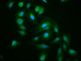 Kinesin-Like 7 / KIF15 Antibody - Immunofluorescence staining of Hela cells at a dilution of 1:200, counter-stained with DAPI. The cells were fixed in 4% formaldehyde, permeabilized using 0.2% Triton X-100 and blocked in 10% normal Goat Serum. The cells were then incubated with the antibody overnight at 4 °C.The secondary antibody was Alexa Fluor 488-congugated AffiniPure Goat Anti-Rabbit IgG (H+L) .