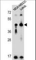 KIR2DL2 / CD158b Antibody - KIR2DL2 Antibody western blot of MDA-MB231,Jurkat cell line lysates (35 ug/lane). The KIR2DL2 antibody detected the KIR2DL2 protein (arrow).
