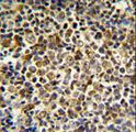 KIR2DL5B Antibody - KIR2DL5B Antibody IHC of formalin-fixed and paraffin-embedded tonsil tissue followed by peroxidase-conjugated secondary antibody and DAB staining.