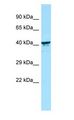 KIR2DL5B Antibody - KIR2DL5B antibody Western Blot of Fetal kidney.  This image was taken for the unconjugated form of this product. Other forms have not been tested.