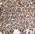 KIR2DS3 Antibody - KIR2DS3 Antibody immunohistochemistry of formalin-fixed and paraffin-embedded human spleen tissue followed by peroxidase-conjugated secondary antibody and DAB staining.