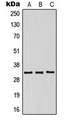 KIR2DS5 Antibody - Western blot analysis of CD158g expression in HeLa (A); SP2/0 (B); NIH3T3 (C) whole cell lysates.
