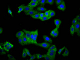 KIR2DS5 Antibody - Immunofluorescence staining of HepG2 cells diluted at 1:100, counter-stained with DAPI. The cells were fixed in 4% formaldehyde, permeabilized using 0.2% Triton X-100 and blocked in 10% normal Goat Serum. The cells were then incubated with the antibody overnight at 4°C.The Secondary antibody was Alexa Fluor 488-congugated AffiniPure Goat Anti-Rabbit IgG (H+L).