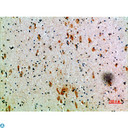 KIR3DL2 Antibody - Immunohistochemical analysis of paraffin-embedded human-brain, antibody was diluted at 1:200.