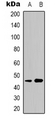 KIR3DL3 / CD158z Antibody - Western blot analysis of CD158z expression in K562 (A); A549 (B) whole cell lysates.