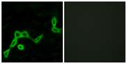 KISS1R / GPR54 Antibody - Immunofluorescence analysis of LOVO cells, using KISS1R Antibody. The picture on the right is blocked with the synthesized peptide.