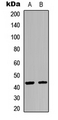 KISS1R / GPR54 Antibody - Western blot analysis of GPR54 expression in HEK293T (A); A549 (B) whole cell lysates.