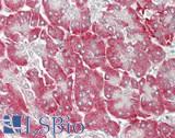 KLB / Beta Klotho Antibody - Human Pancreas: Formalin-Fixed, Paraffin-Embedded (FFPE).  This image was taken for the unconjugated form of this product. Other forms have not been tested.