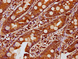 KLB / Beta Klotho Antibody - Immunohistochemistry Dilution at 1:200 and staining in paraffin-embedded human small intestine tissue performed on a Leica BondTM system. After dewaxing and hydration, antigen retrieval was mediated by high pressure in a citrate buffer (pH 6.0). Section was blocked with 10% normal Goat serum 30min at RT. Then primary antibody (1% BSA) was incubated at 4°C overnight. The primary is detected by a biotinylated Secondary antibody and visualized using an HRP conjugated SP system.