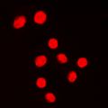 Antibody - Immunofluorescent analysis of KLF1/5/7 staining in Jurkat cells. Formalin-fixed cells were permeabilized with 0.1% Triton X-100 in TBS for 5-10 minutes and blocked with 3% BSA-PBS for 30 minutes at room temperature. Cells were probed with the primary antibody in 3% BSA-PBS and incubated overnight at 4 C in a humidified chamber. Cells were washed with PBST and incubated with a DyLight 594-conjugated secondary antibody (red) in PBS at room temperature in the dark. DAPI was used to stain the cell nuclei (blue).