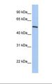 KLF11 Antibody - 721_B cell lysate. Antibody concentration: 1.0 ug/ml. Gel concentration: 12%.  This image was taken for the unconjugated form of this product. Other forms have not been tested.