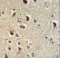 KLF11 Antibody - Formalin-fixed and paraffin-embedded human brain tissue reacted with TIEG2 Antibody , which was peroxidase-conjugated to the secondary antibody, followed by DAB staining. This data demonstrates the use of this antibody for immunohistochemistry; clinical relevance has not been evaluated.