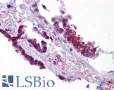 KLF2 Antibody - Anti-KLF2 antibody IHC of human lung. Immunohistochemistry of formalin-fixed, paraffin-embedded tissue after heat-induced antigen retrieval. Antibody concentration 5 ug/ml.  This image was taken for the unconjugated form of this product. Other forms have not been tested.