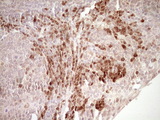 KLF2 Antibody - IHC of paraffin-embedded Human tonsil using anti-KLF2 mouse monoclonal antibody. (Heat-induced epitope retrieval by 1 mM EDTA in 10mM Tris, pH8.5, 120°C for 3min).