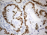 KLF5 / BTEB2 Antibody - Immunohistochemical staining of paraffin-embedded Carcinoma of Human spleen tissue within the normal limits using anti-KLF5 mouse monoclonal antibody. (Heat-induced epitope retrieval by 1mM EDTA in 10mM Tris buffer. (pH8.5) at 120°C for 3 min. (1:5000)