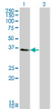 KLF6 Antibody - Western Blot analysis of KLF6 expression in transfected 293T cell line by KLF6 monoclonal antibody (M01), clone 1A9.Lane 1: KLF6 transfected lysate(28.71 KDa).Lane 2: Non-transfected lysate.