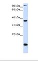 KLF8 Antibody - Placenta lysate. Antibody concentration: 1.0 ug/ml. Gel concentration: 12%.  This image was taken for the unconjugated form of this product. Other forms have not been tested.