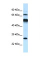 KLHL1 Antibody - KLHL1 antibody Western blot of Rat Brain lysate. Antibody concentration 1 ug/ml.  This image was taken for the unconjugated form of this product. Other forms have not been tested.