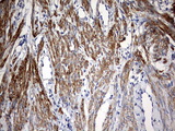 KLHL12 Antibody - IHC of paraffin-embedded Human endometrium tissue using anti-KLHL12 mouse monoclonal antibody. (Heat-induced epitope retrieval by 10mM citric buffer, pH6.0, 120°C for 3min).
