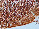 KLHL20 Antibody - Immunohistochemistry Dilution at 1:300 and staining in paraffin-embedded human lung tissue performed on a Leica BondTM system. After dewaxing and hydration, antigen retrieval was mediated by high pressure in a citrate buffer (pH 6.0). Section was blocked with 10% normal Goat serum 30min at RT. Then primary antibody (1% BSA) was incubated at 4°C overnight. The primary is detected by a biotinylated Secondary antibody and visualized using an HRP conjugated SP system.