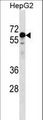 KLHL25 Antibody - KLHL25 Antibody western blot of HepG2 cell line lysates (35 ug/lane). The KLHL25 antibody detected the KLHL25 protein (arrow).