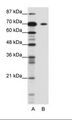 KLHL26 Antibody - A: Marker, B: Jurkat Cell Lysate.  This image was taken for the unconjugated form of this product. Other forms have not been tested.