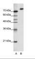 KLHL3 Antibody - A: Marker, B: HepG2 Cell Lysate.  This image was taken for the unconjugated form of this product. Other forms have not been tested.