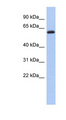 KLHL7 Antibody - KLHL7 antibody Western blot of Fetal Brain lysate. This image was taken for the unconjugated form of this product. Other forms have not been tested.
