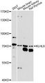 KLHL8 Antibody - Western blot analysis of extracts of various cell lines, using KLHL8 antibody at 1:1000 dilution. The secondary antibody used was an HRP Goat Anti-Rabbit IgG (H+L) at 1:10000 dilution. Lysates were loaded 25ug per lane and 3% nonfat dry milk in TBST was used for blocking. An ECL Kit was used for detection and the exposure time was 90s.