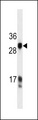 KLK3 / PSA Antibody - HKLK3 Antibody (C234) western blot of A549 cell line lysates (35 ug/lane). The HKLK3 antibody detected the HKLK3 protein (arrow).