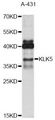 KLK5 / Kallikrein 5 Antibody - Western blot analysis of extracts of A-431 cells, using KLK5 antibody at 1:1000 dilution. The secondary antibody used was an HRP Goat Anti-Rabbit IgG (H+L) at 1:10000 dilution. Lysates were loaded 25ug per lane and 3% nonfat dry milk in TBST was used for blocking. An ECL Kit was used for detection and the exposure time was 30s.
