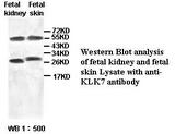 KLK7 / Kallikrein 7 Antibody